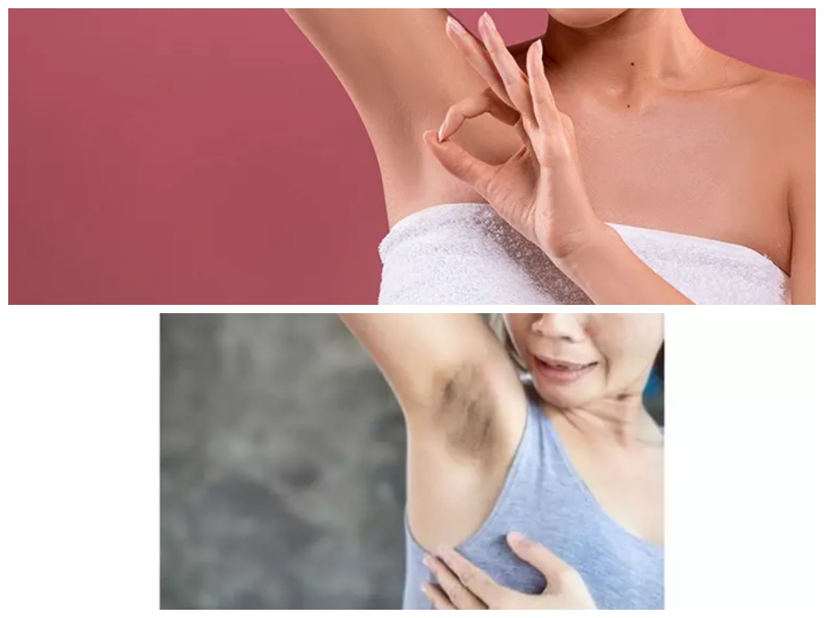 Rahasia Ketiak Wangi dan Cerah: Cukup 3 Bahan Alami Ini!