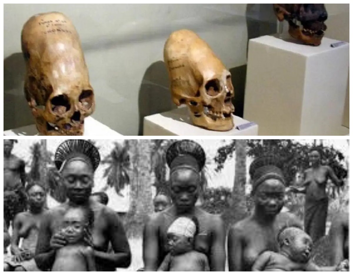 Keunikan Suku di Kongo: Kepala yang Menyerupai Karakter Alien
