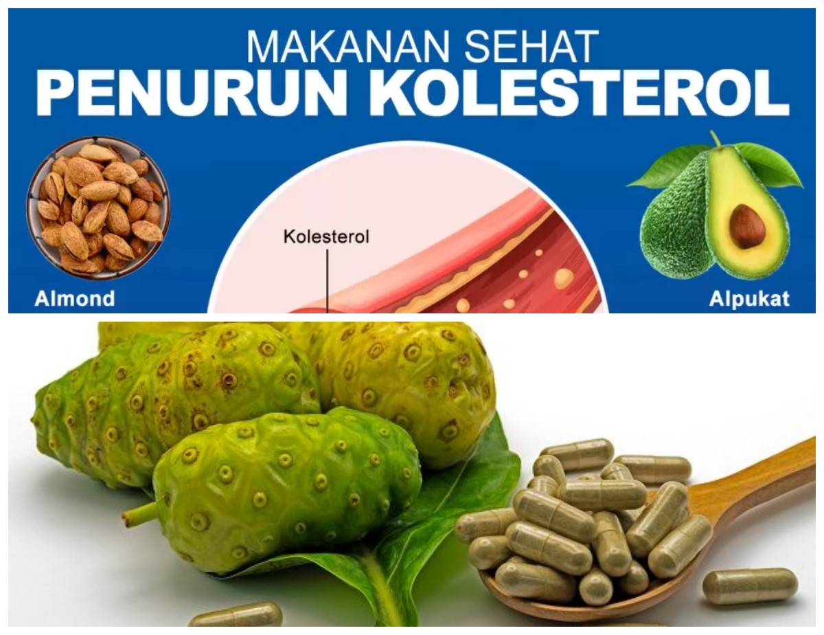 Tips Alami! 6 Cara Efisien Mengatasi Kolesterol Tinggi