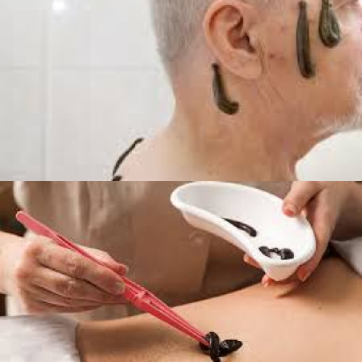  Wow Yuk Simak Terapi Lintah, Ini 5 Manfaatnya untuk Kesehatan!