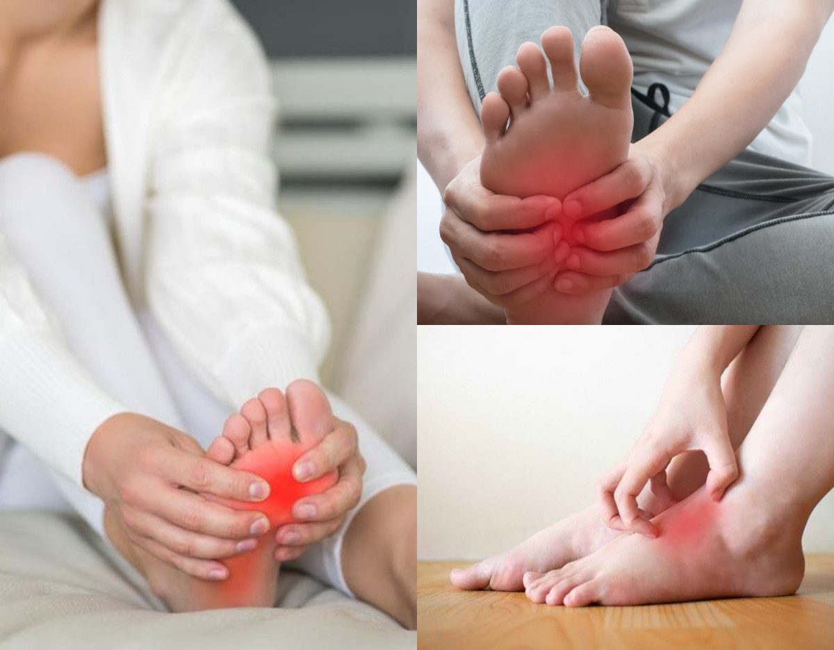 Telapak kaki Gatal bisa Disebabkan oleh Berbagai Kondisi Tertentu, Ini Penyebab dan Tips Mengatasinya