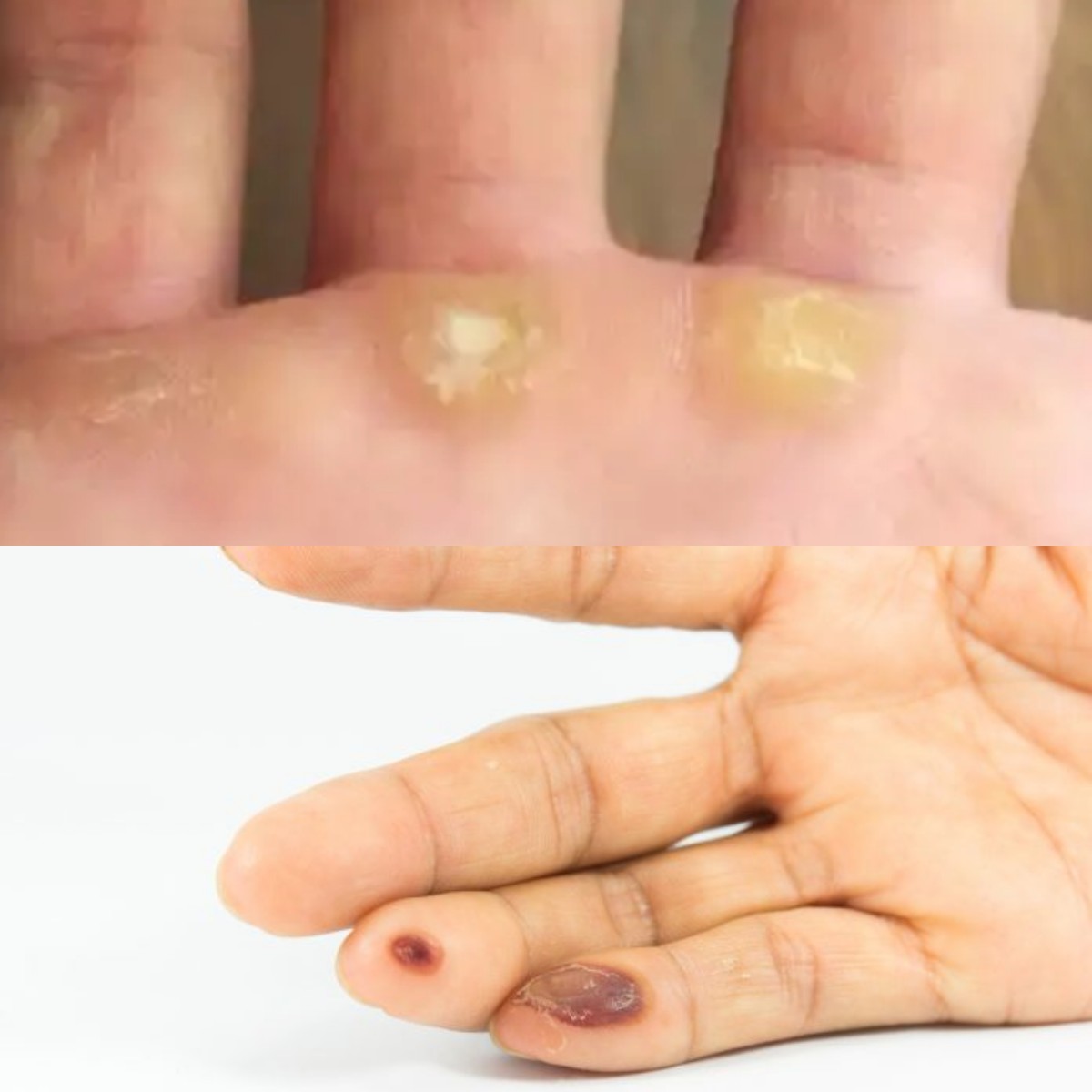  Mata Ikan di Tangan, Pahami Alasan dan Metode untuk Menyingkirkannya