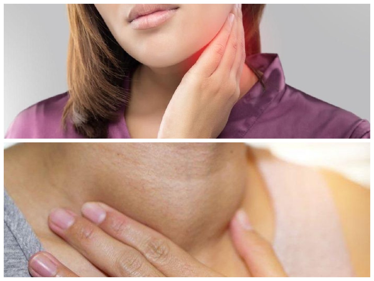 Atasi Kelenjar Getah Bening Bengkak dengan Cepat, Begini Caranya!