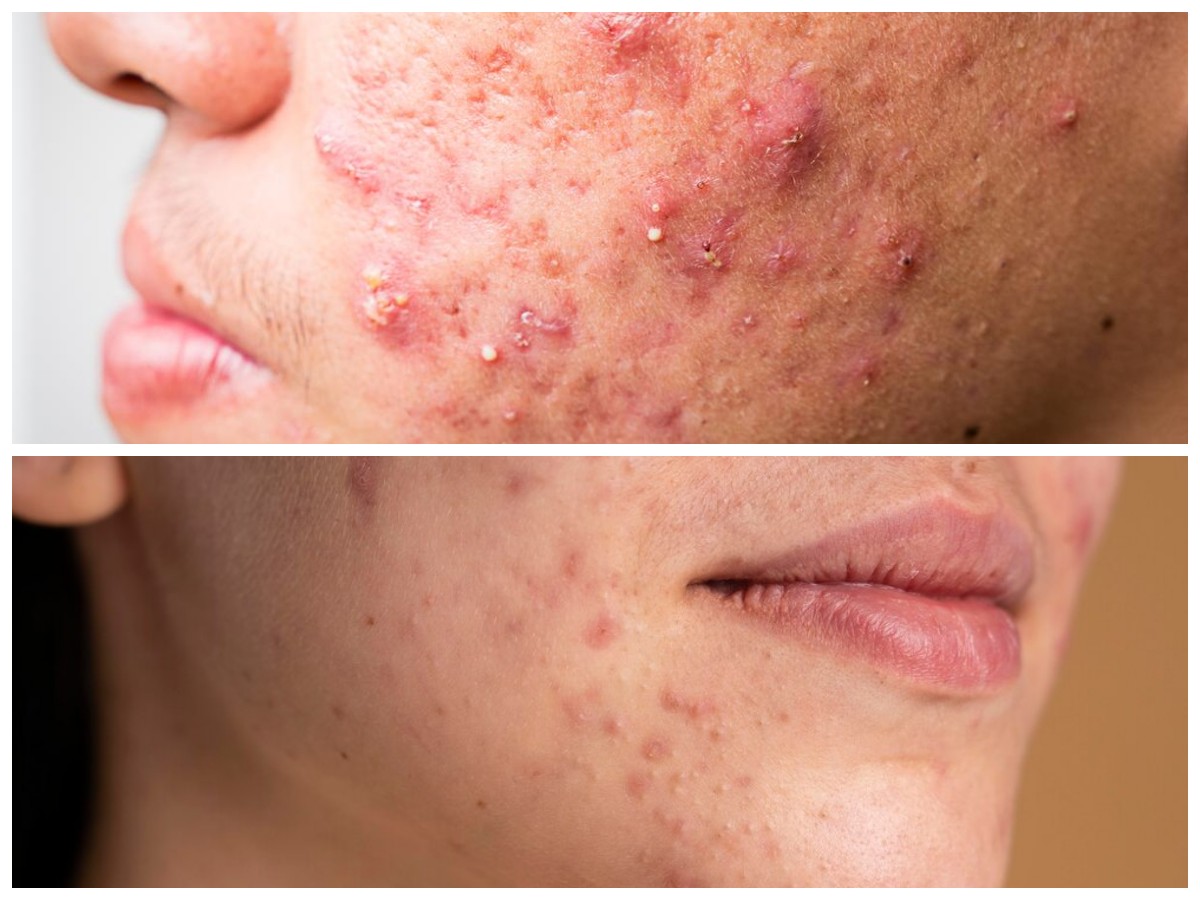 Tanda-tanda Alergi Kosmetik yang Wajib Kamu Ketahui untuk Hindari Risiko