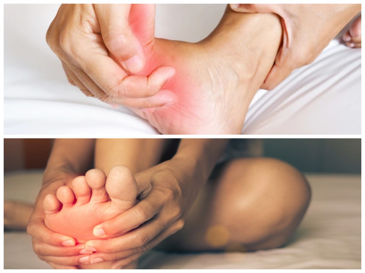 Kenali Berbagai Penyebab Kram pada Kaki dan Cara Mengatasinya