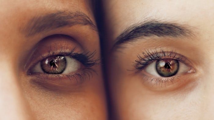 InI Dia 8 Penyebab Katung Mata Bengkak yang Perlu Kamu Ketahui