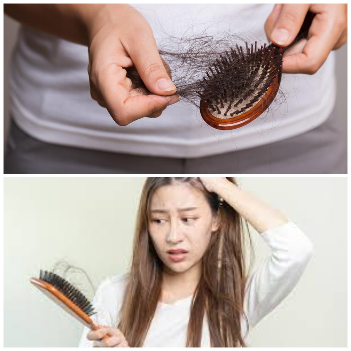  Inilah Penyebab Rambut Rontok Berlebihan Yang Perlu Anda Ketahui!