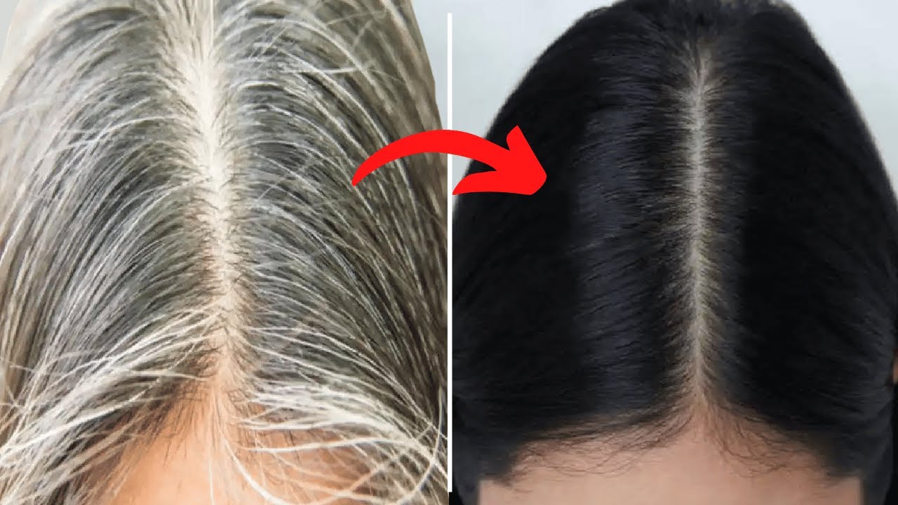 Pilih 4 Merk Shampo Ini Untuk Hilangkan Uban Rambut Yang Sangat Menggangu Penampilanmu!