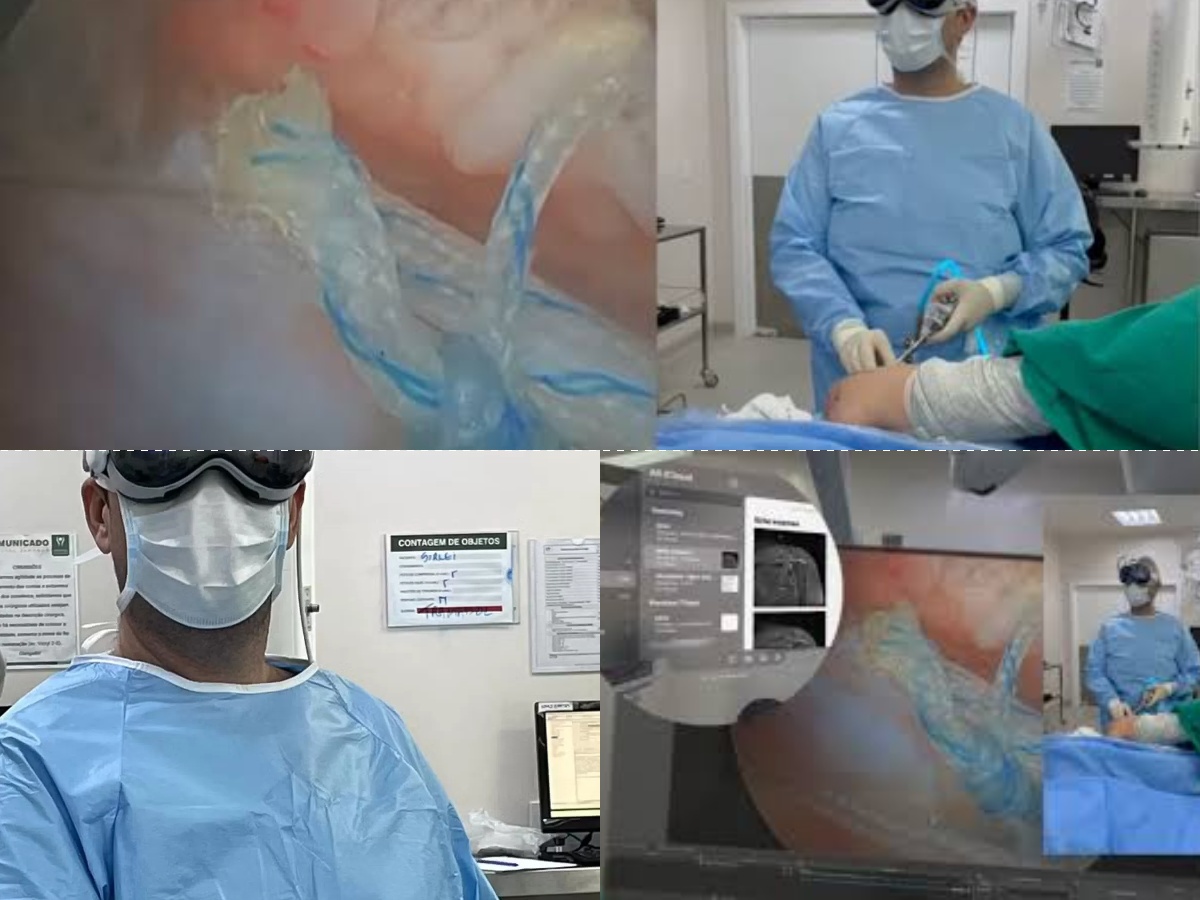 Teknologi Terbaru dalam Bedah: Dokter Ortopedi Brasil Berhasil Gunakan Apple Vision Pro untuk Operasi Bahu