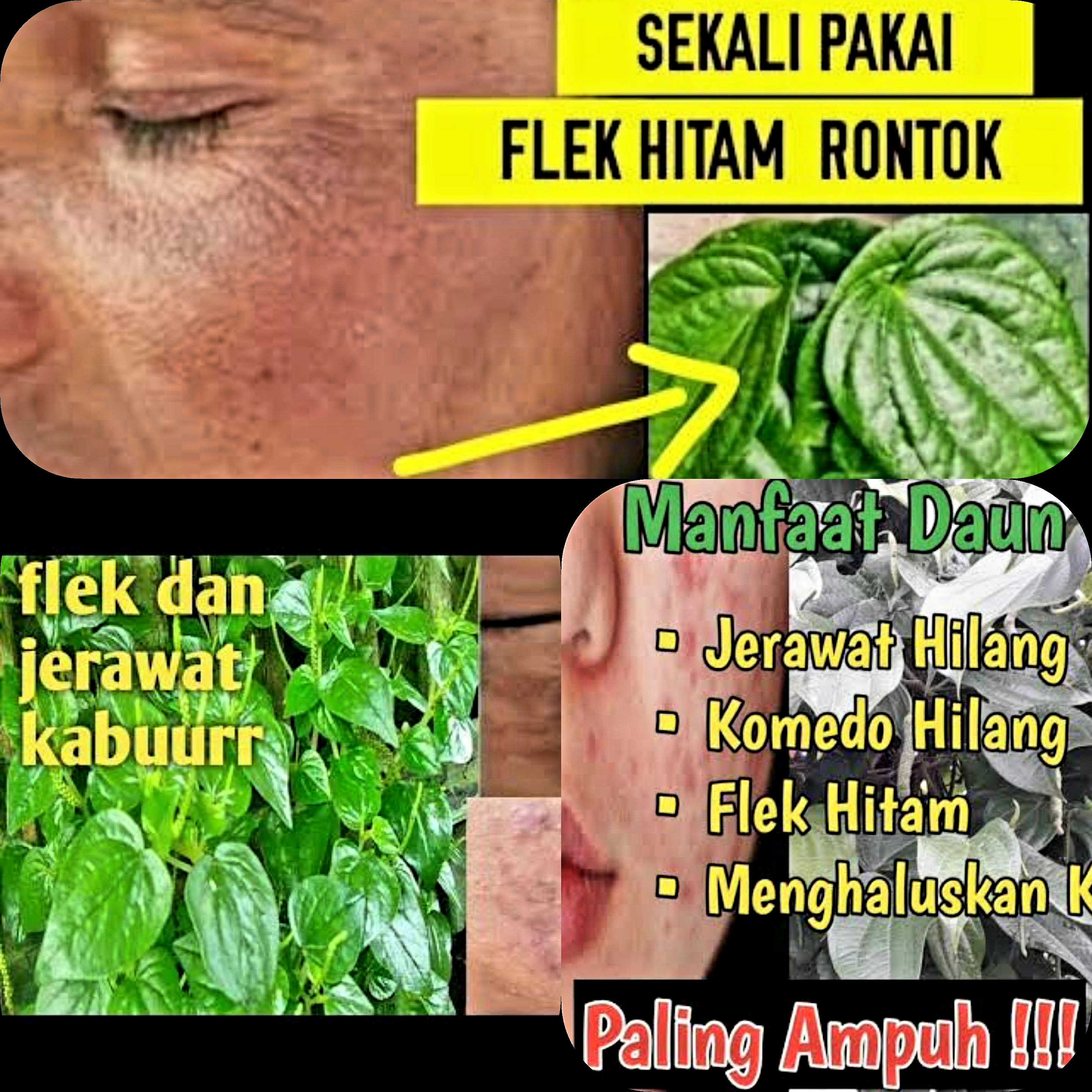 Kembali Glowing! Usir Flek Hitam dengan Cara Ampuh Ini! Dijamin Noda di Wajah Tak Kembali