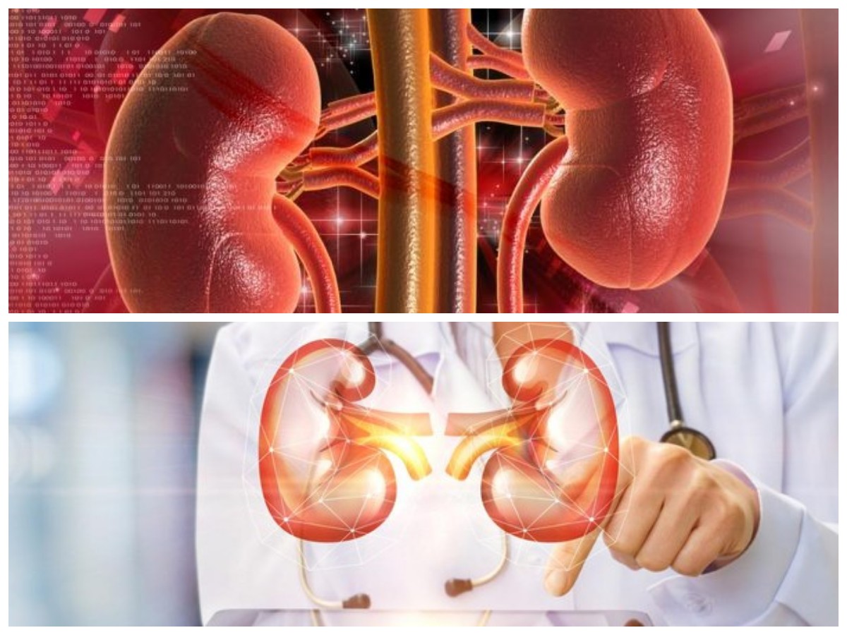 Waspada! Hindari 10 Kebiasaan Ini Jika Kamu Tak Ingin Kena Penyakit Batu Ginjal 