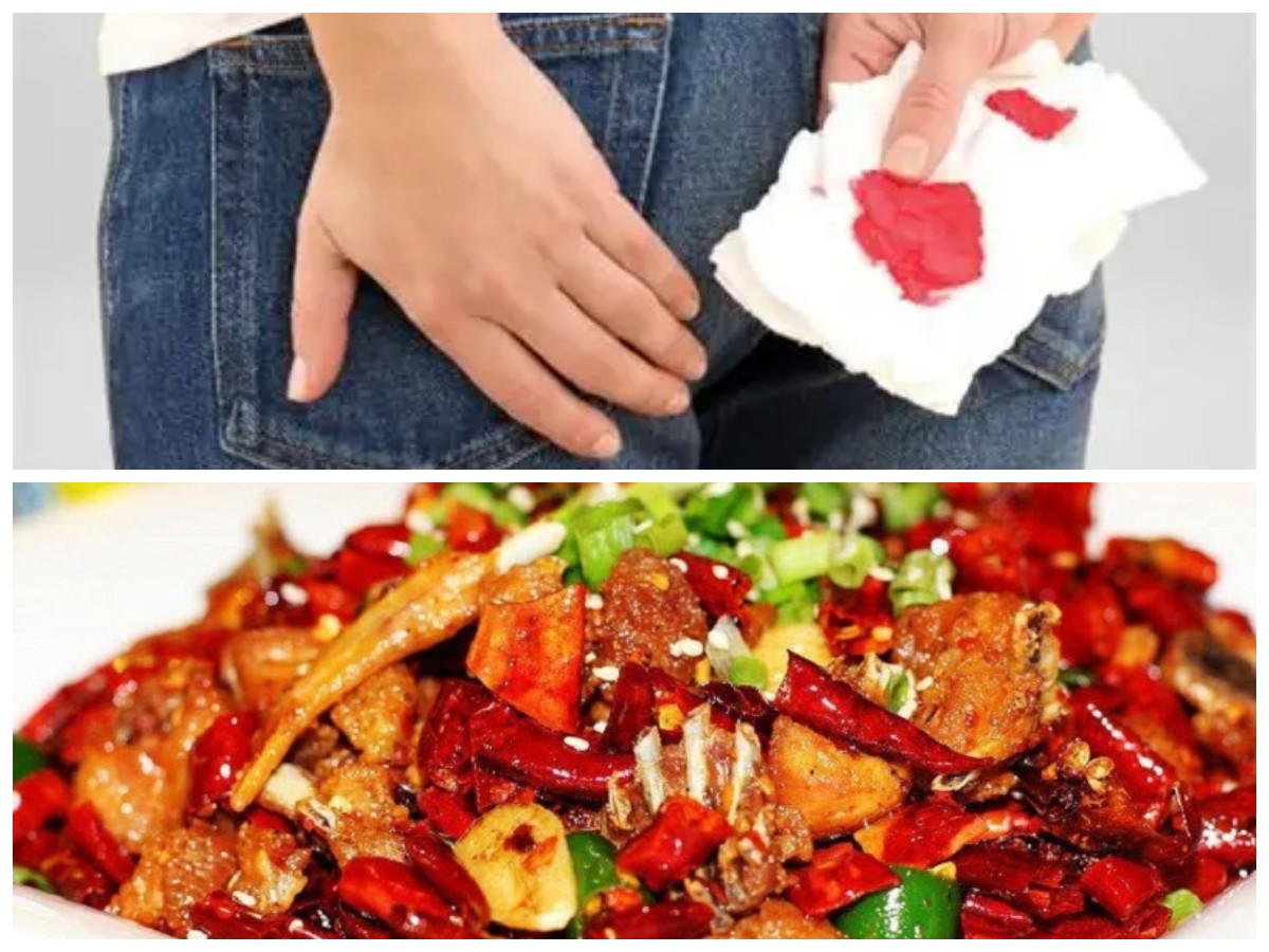 Waspadai! Ini Daftar Makanan yang Bisa Memicu BAB Berdarah Selain Makanan Pedas