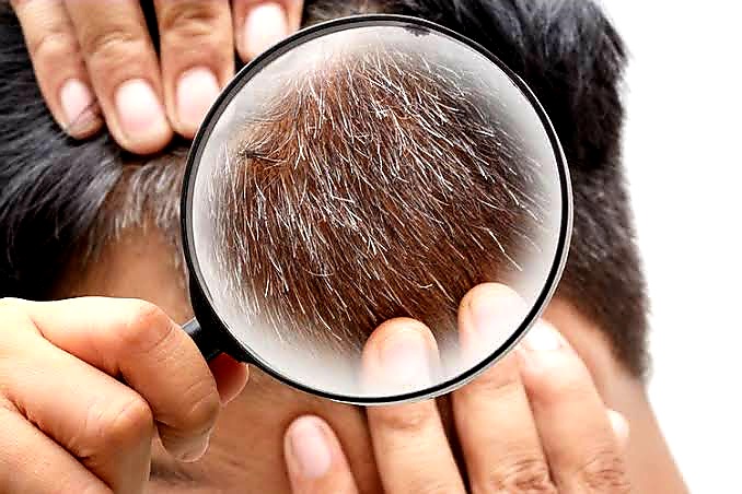 Pengusir Uban Paling Ampuh! Cukup Pake Shampo Ini Rambut Putihmu Kembali Lrgam