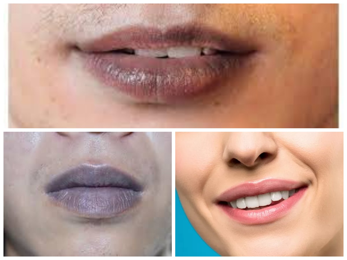 Bibir Hitam Tidak Percaya Diri? Inilah Tips Mengatasi Bibir Hitam, Ampuh dan Alami!