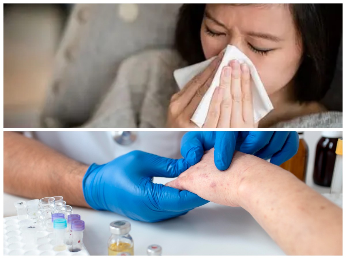 Sering Bereaksi Saat Terpapar Jamur? Ini Tanda Alergi dan Cara Mengatasinya