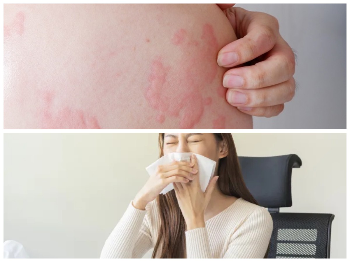 Waspada Alergi Dingin dan Debu? Ini Cara Ampuh Meredakannya!