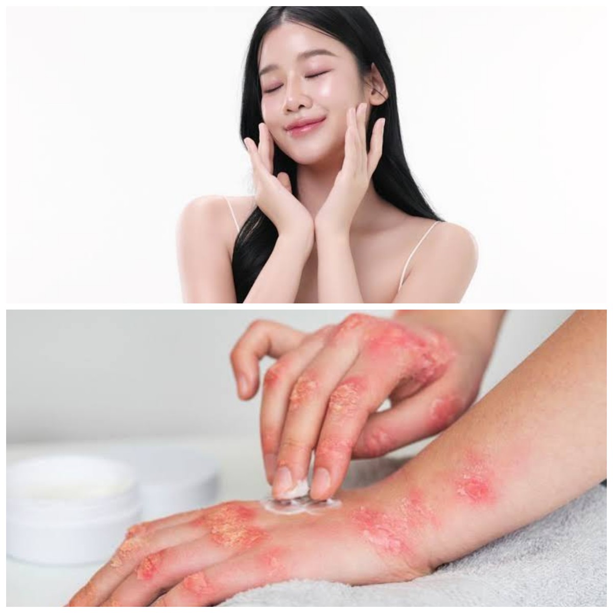 Bisa Dilakukan di Rumah, Ini Trik Menjaga Kulit Tetap Sehat dan Terhindar dari Infeksi Kronis!