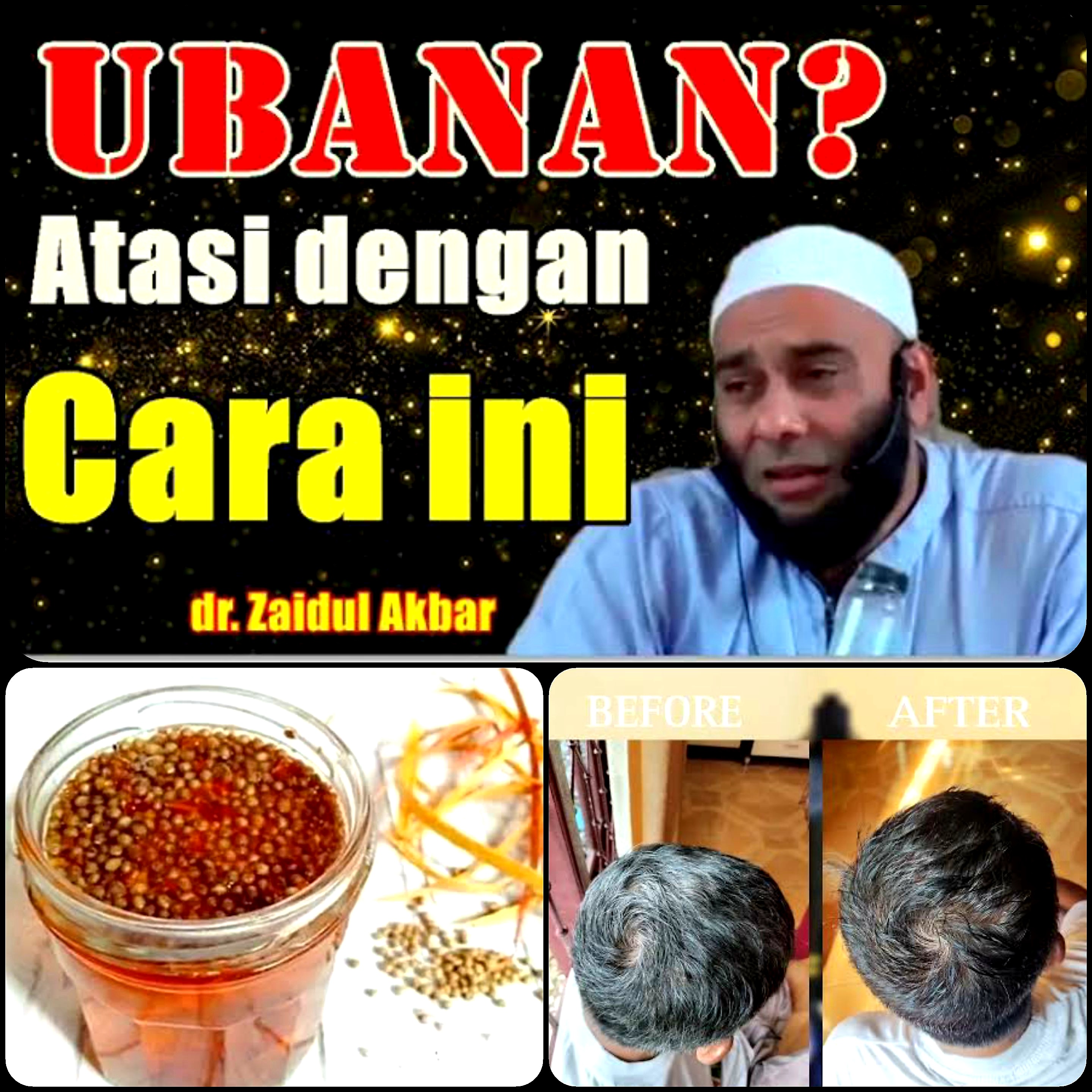 Kata Pakar Herbal dr. Zaidul Akbar Semir Rambut Beruban Itu Ada di Dapur! Pake 3 Bumbu Ini?