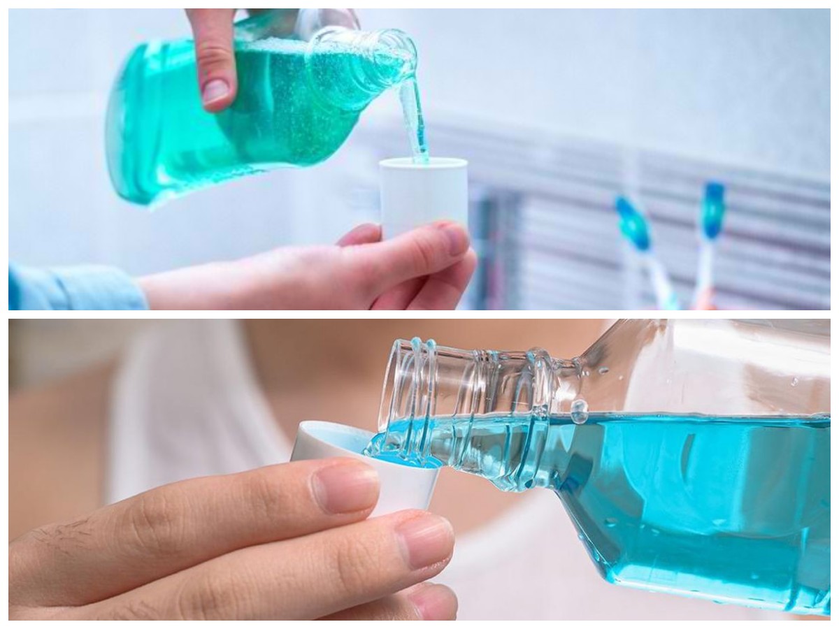 Rahasia Obat Kumur: Cara Praktis Menjaga Kesehatan Mulut Setiap Hari!