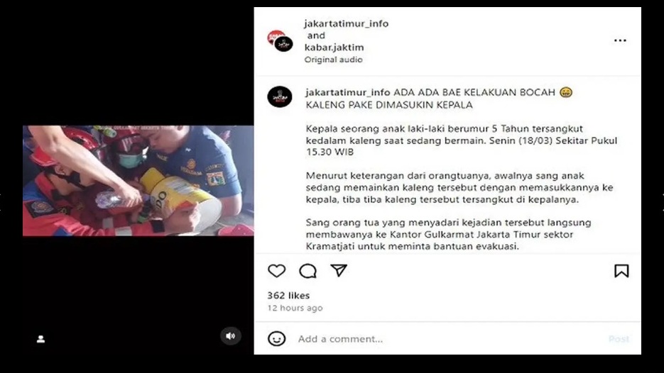 Heboh, Kepala Bocah 5 Tahun Tersangkut Kaleng Susu di Jakarta Timur, Petugas Damkar Turun Tangan