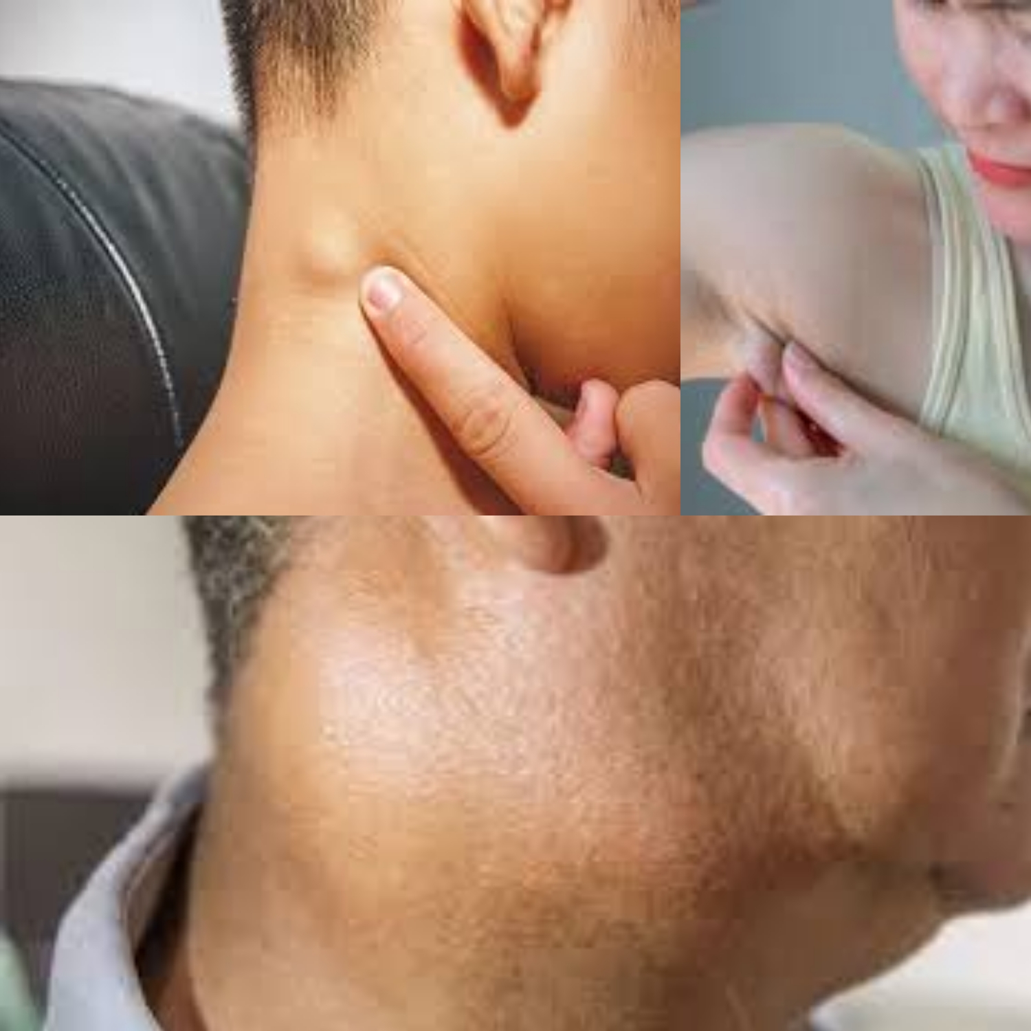 Cari Tahu Gejala Pembengkakan Kelenjar Getah Bening dan Bagiamana Pengobatan yang Tepat!