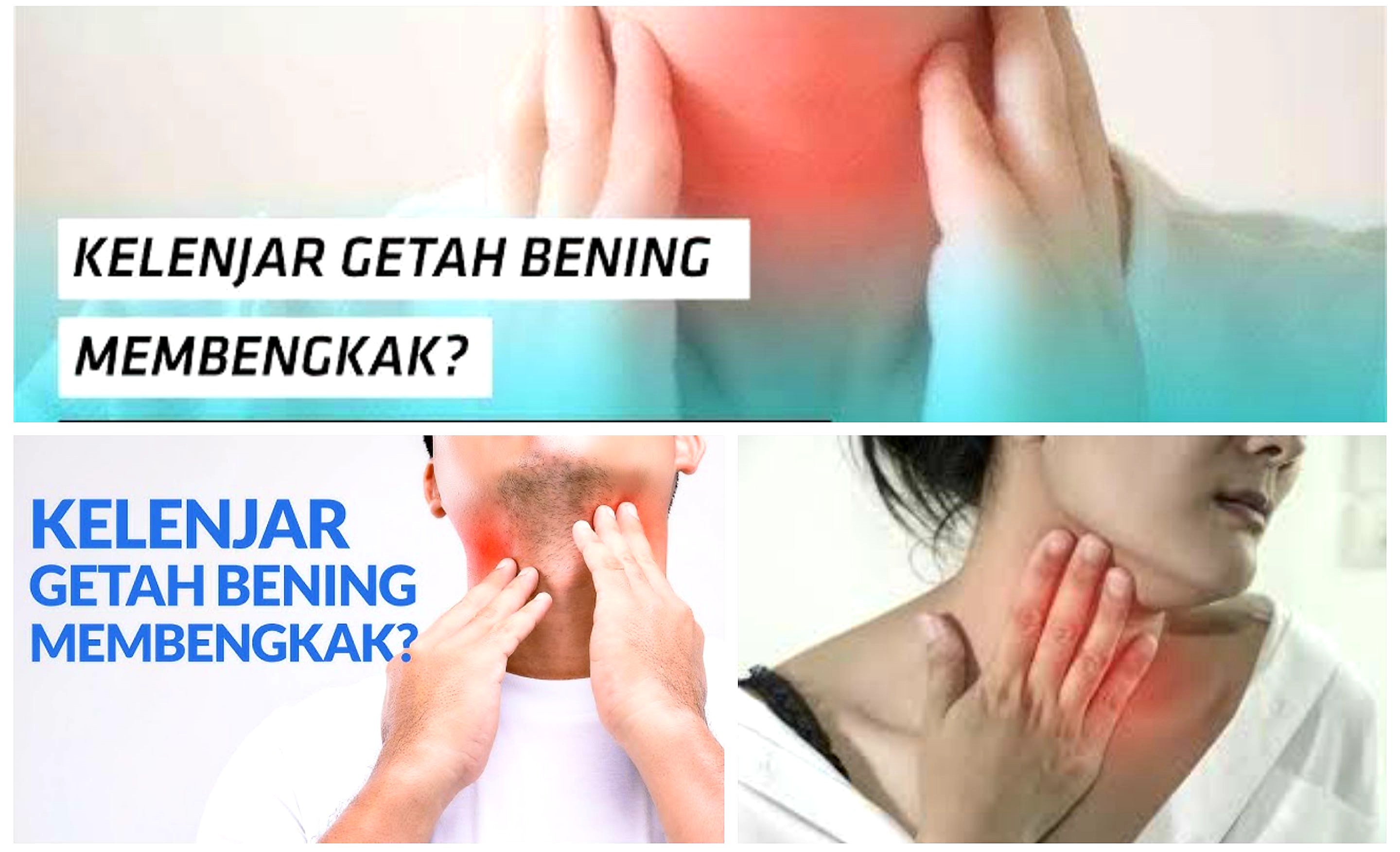 Jangan Sampai Tidak Tahu Cara Mudah Atasi Getah Bening
