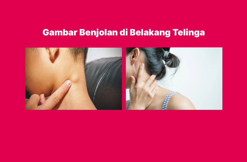 Jangan Diabaikan! 6 Benjolan di Dalam Telinga Ini Bisa Berbahaya, Nomor 5 Paling Serius!