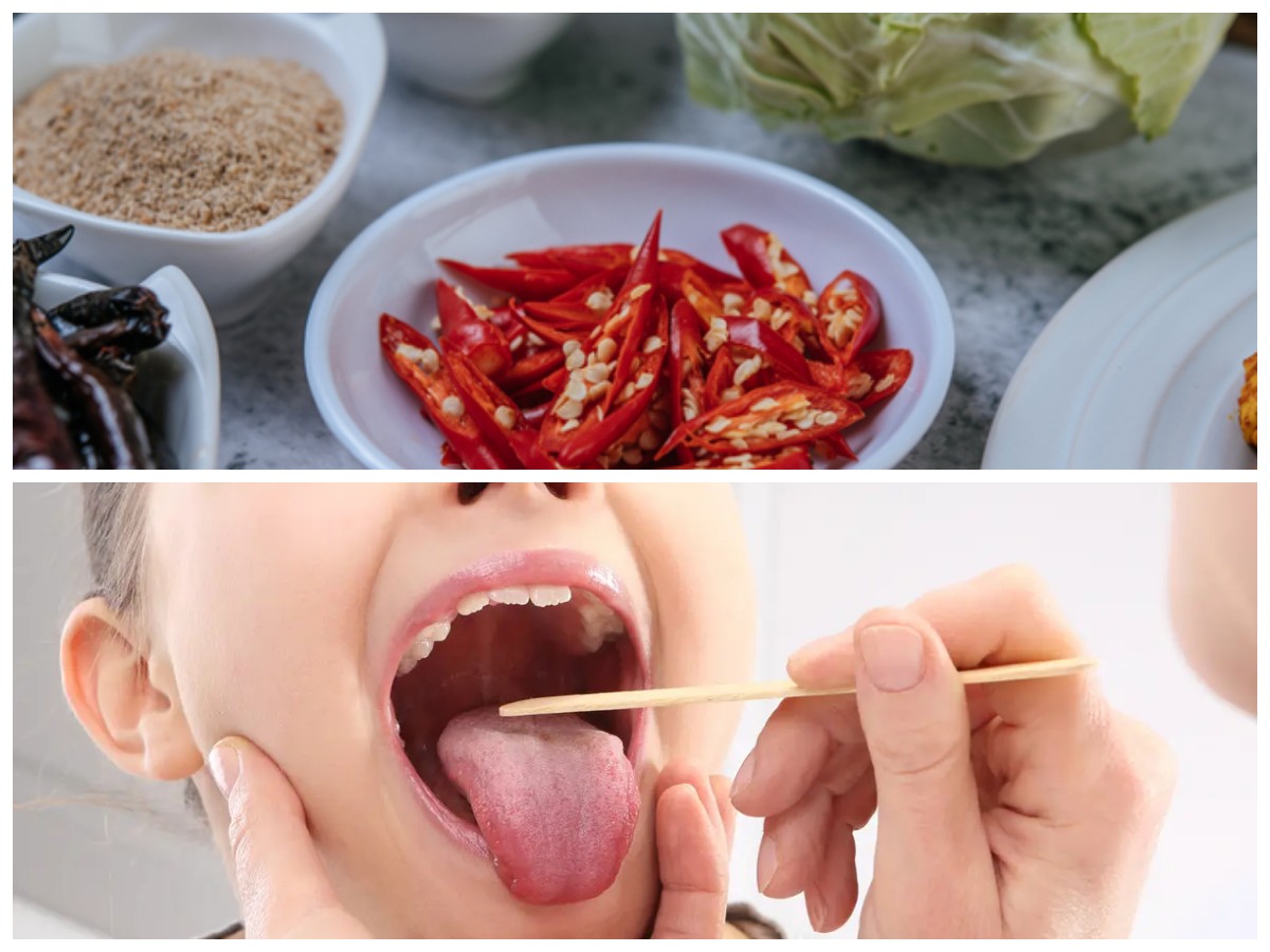 Waspada! Ini 6 Jenis Makanan dan Minuman yang Dapat Memperburuk Penyakit Amandel