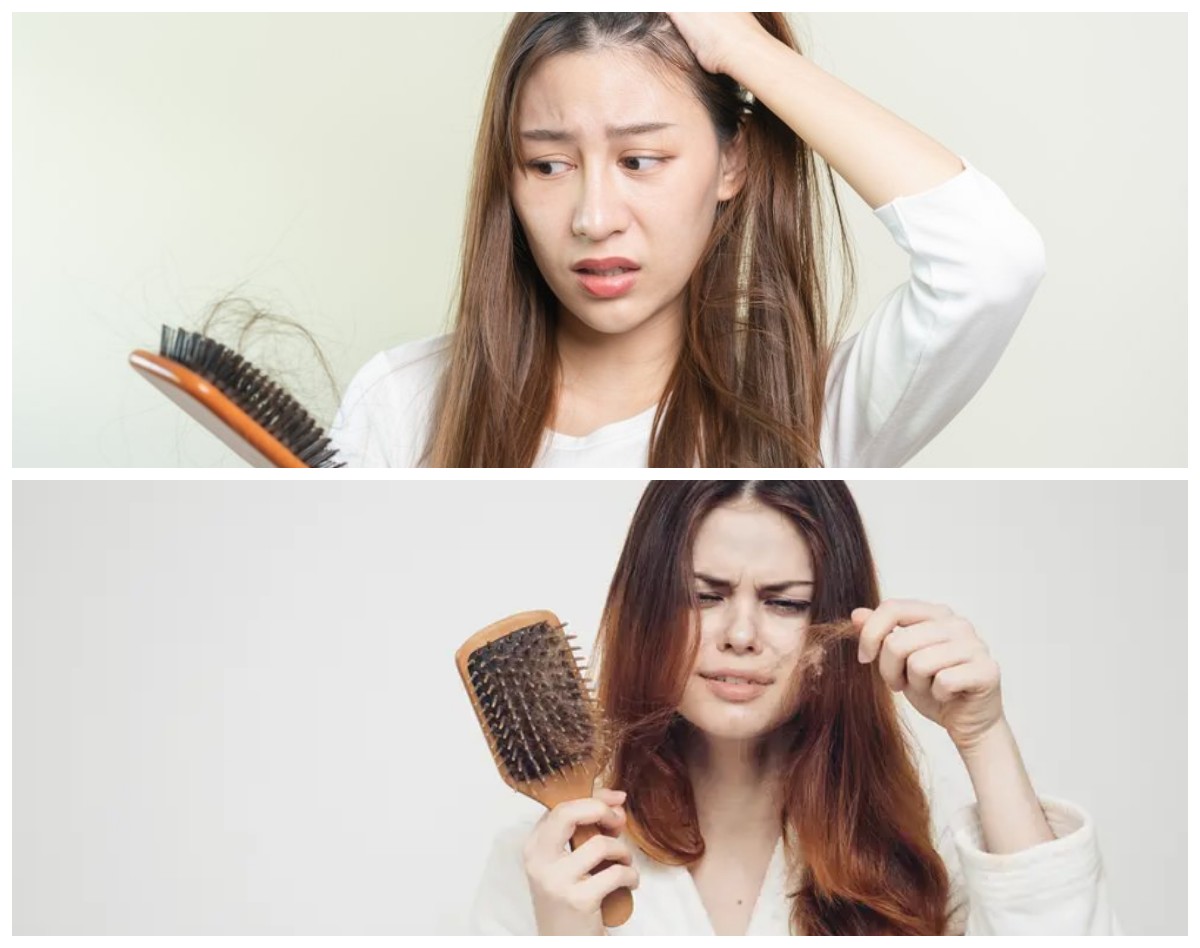 9 Cara Efektif Mengatasi Rambut Rontok Secara Cepat dan Alami