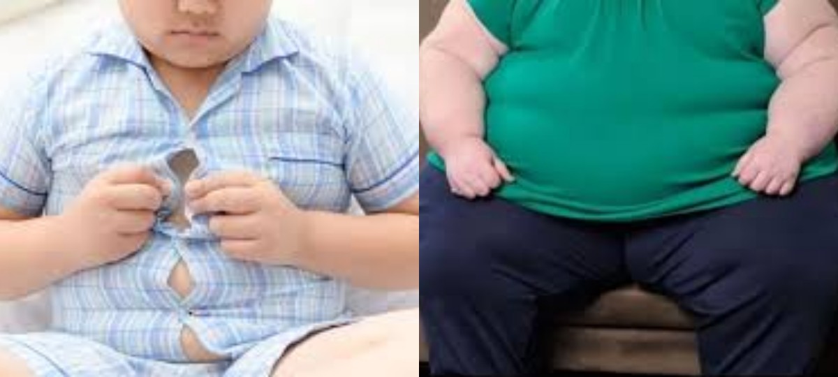 Obesitas pada Dewasa dan Anak: Dampak Kesehatan Jangka Panjang yang Harus Diwaspadai