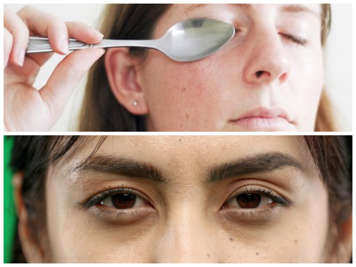 Atasi Mata Panda Tanpa Obat: 10 Tips Alami yang Terbukti