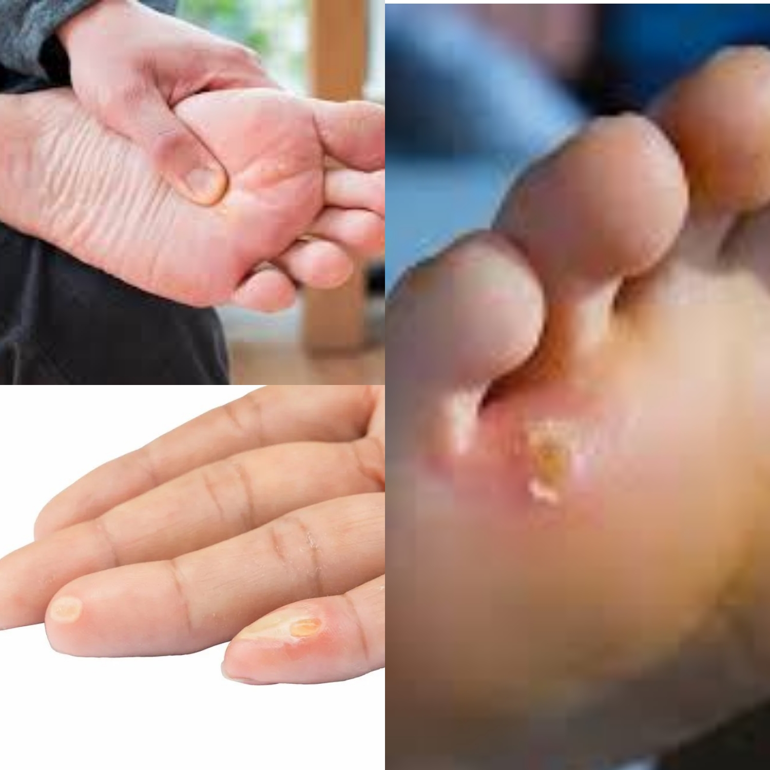 Penyakit Mata Ikan: Penyebab, Gejala, dan Cara Pengobatannya