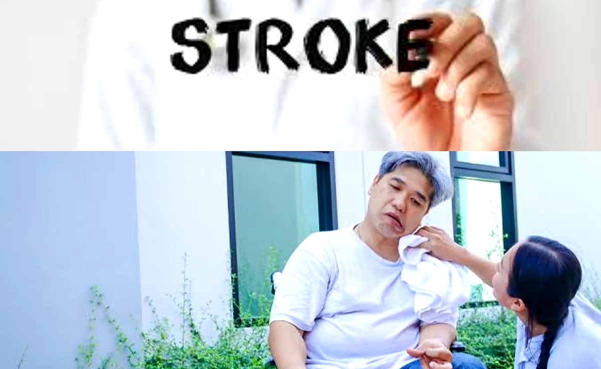 Jarang Disadari! 6 Kebiasaan Ini Tingkatkan Resiko Terkena Stroke