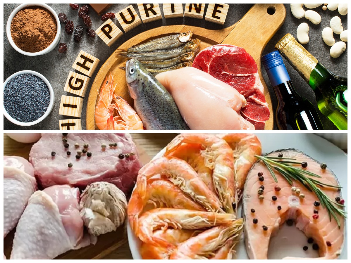 Waspadai! Inilah Daftar Makanan Tinggi Purin Pemicu Asam Urat yang Harus Dihindari