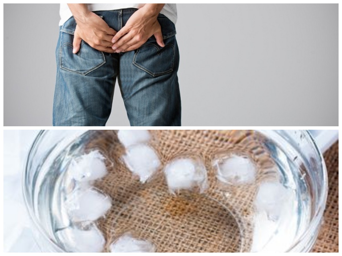 Redakan Wasir dengan Cepat: Metode Alami yang Aman dan Mudah Dilakukan di Rumah