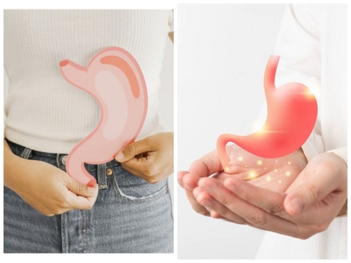 Tips Pencegahan Penyakit Asam Lambung: Pola Hidup Sehat untuk Menjaga Sistem Pencernaan!