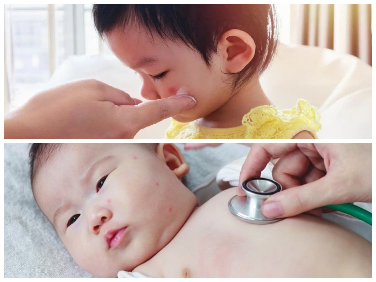 Waspada! Inilah 4 Faktor Penyebab Bisul pada Bayi yang Perlu Orang Tua Ketahui