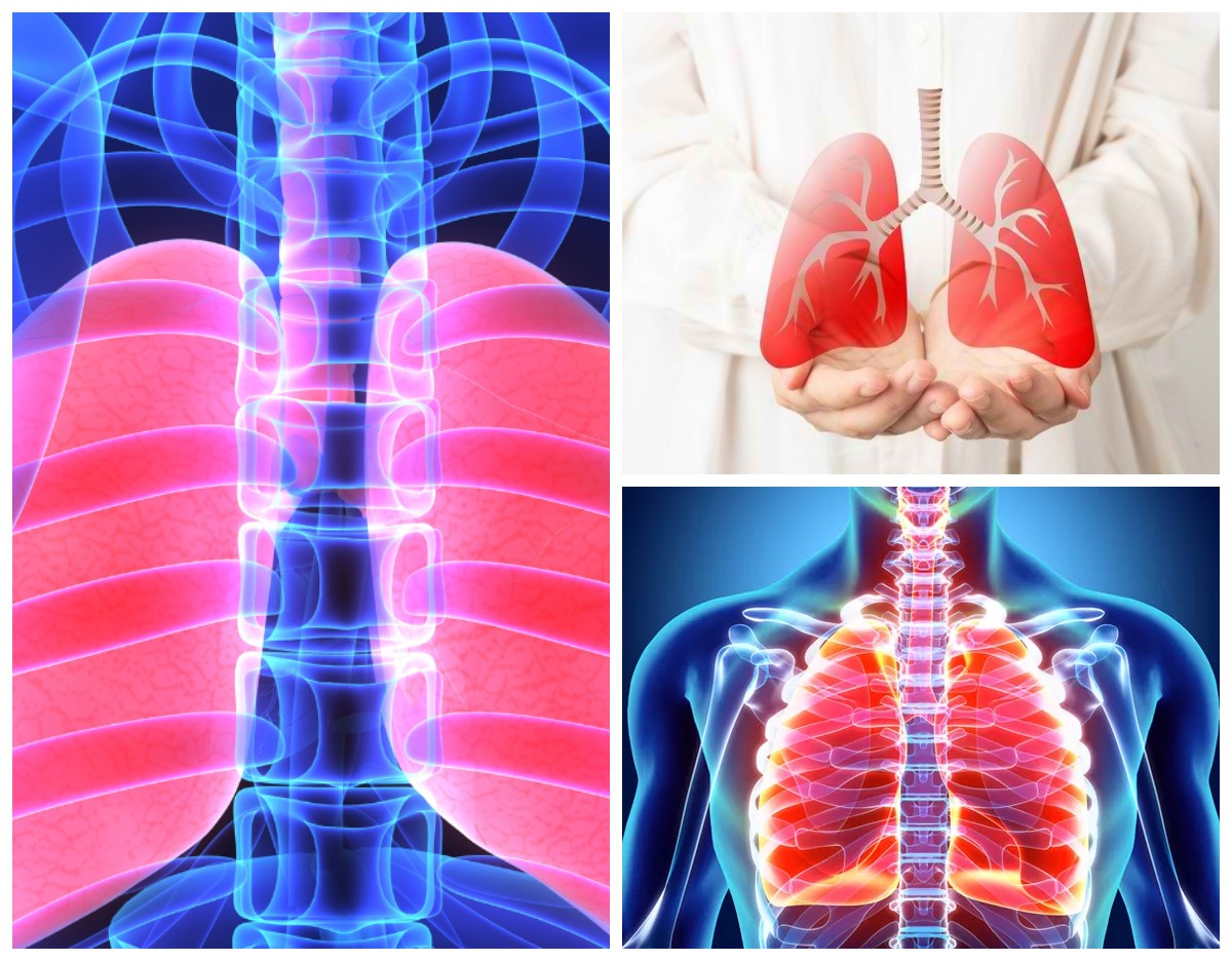 Panduan Sehat: 8 Cara Menjaga Paru-Paru Tetap Bersih dan Kebiasaan yang Harus Dijauhi!