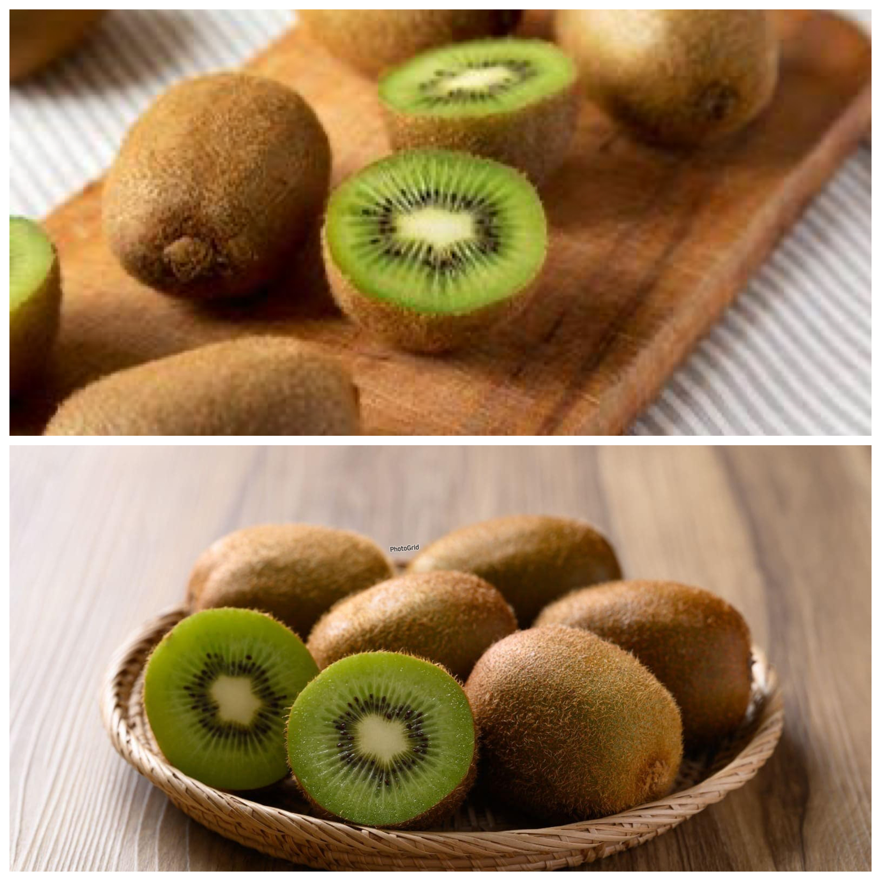 Perlu Diketaui! 5 Manfaat Kiwi untuk Kesehatan yang Sayang Dilewatkan!