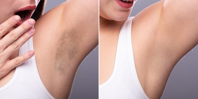 7 Cara Cukur Bulu Ketiak Yang Benar dengan Hasil Maksimal