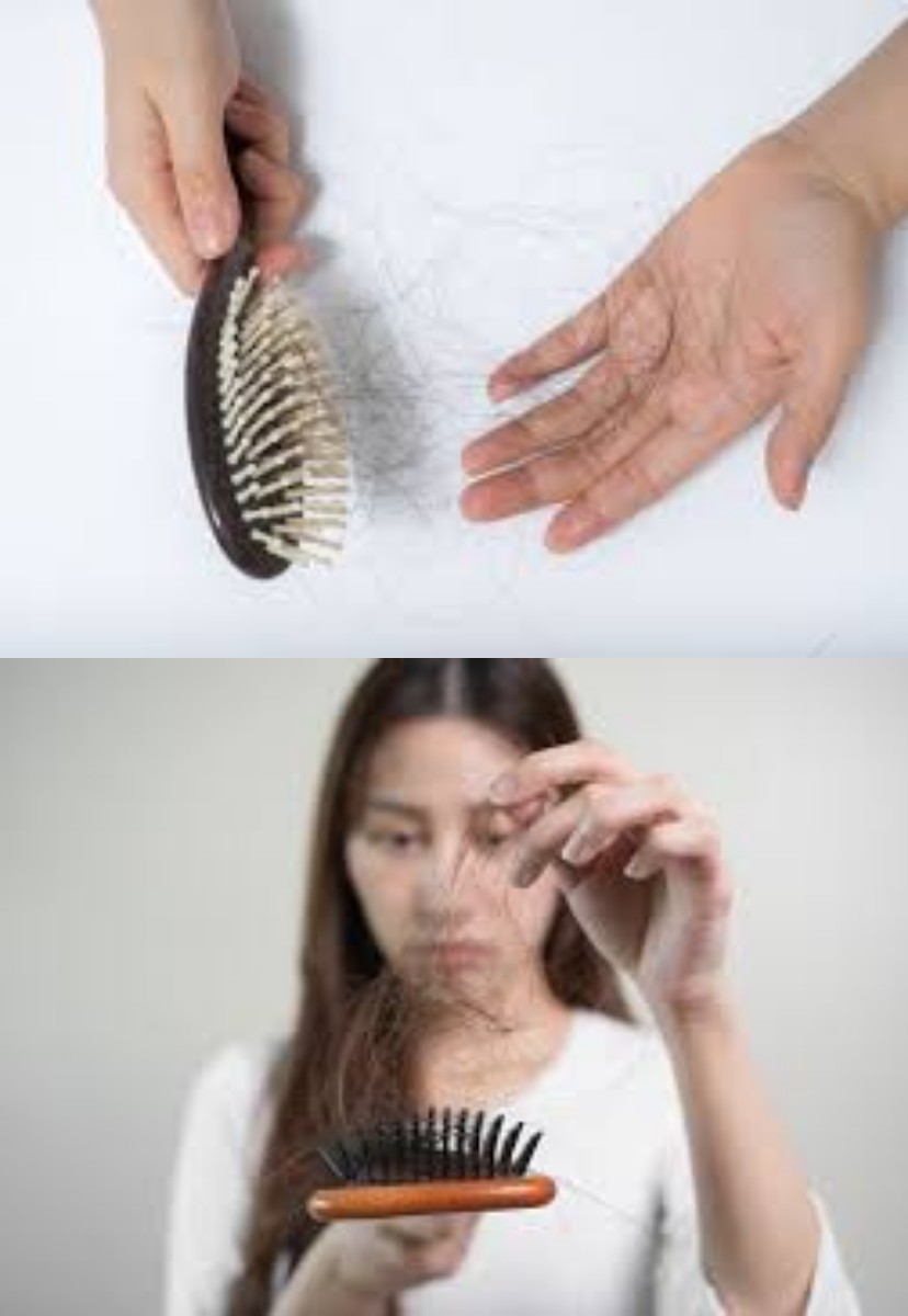 Rambut Rontok, Normal atau Tidak