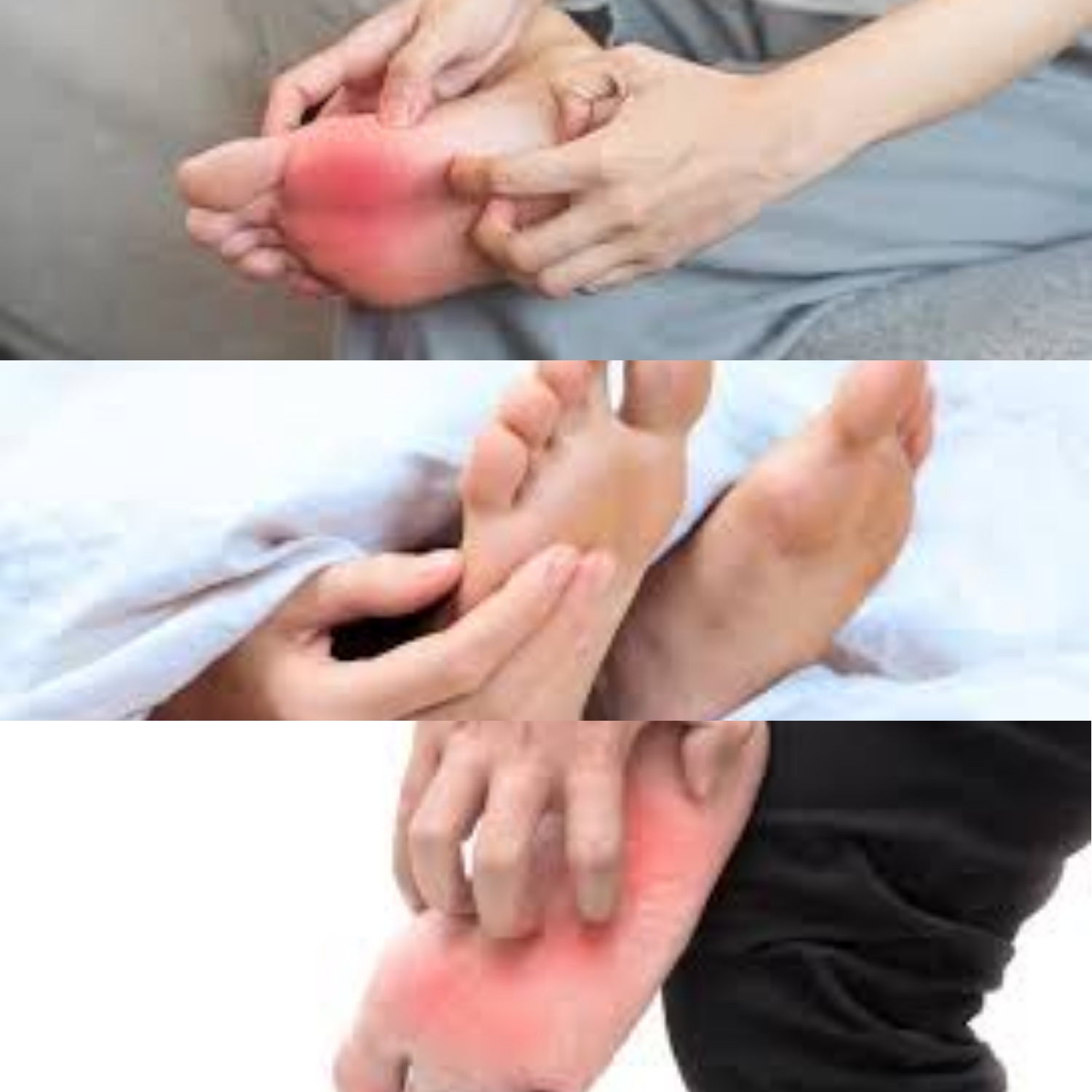 Telapak Kaki Terasa Gatal? Jangan Khawatir, Berikut Penyebab dan Cara Mengatasinya