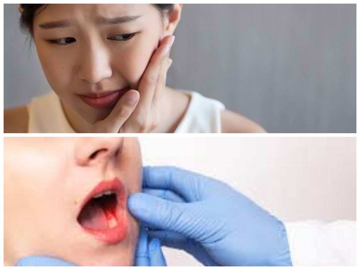 10 Solusi Cepat dan Efektif untuk Mengurangi Gusi Bengkak dan Perdarahan