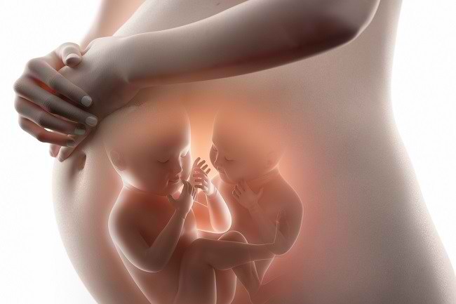Kenali Kehamilan Kembar, Tanda-tanda Hingga Penanganannya