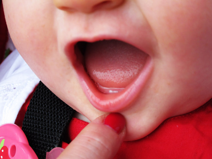 Bunda Catat ini! 7 Makanan Sehat untuk Rangsang Pertumbuhan pada Gigi Bayi 
