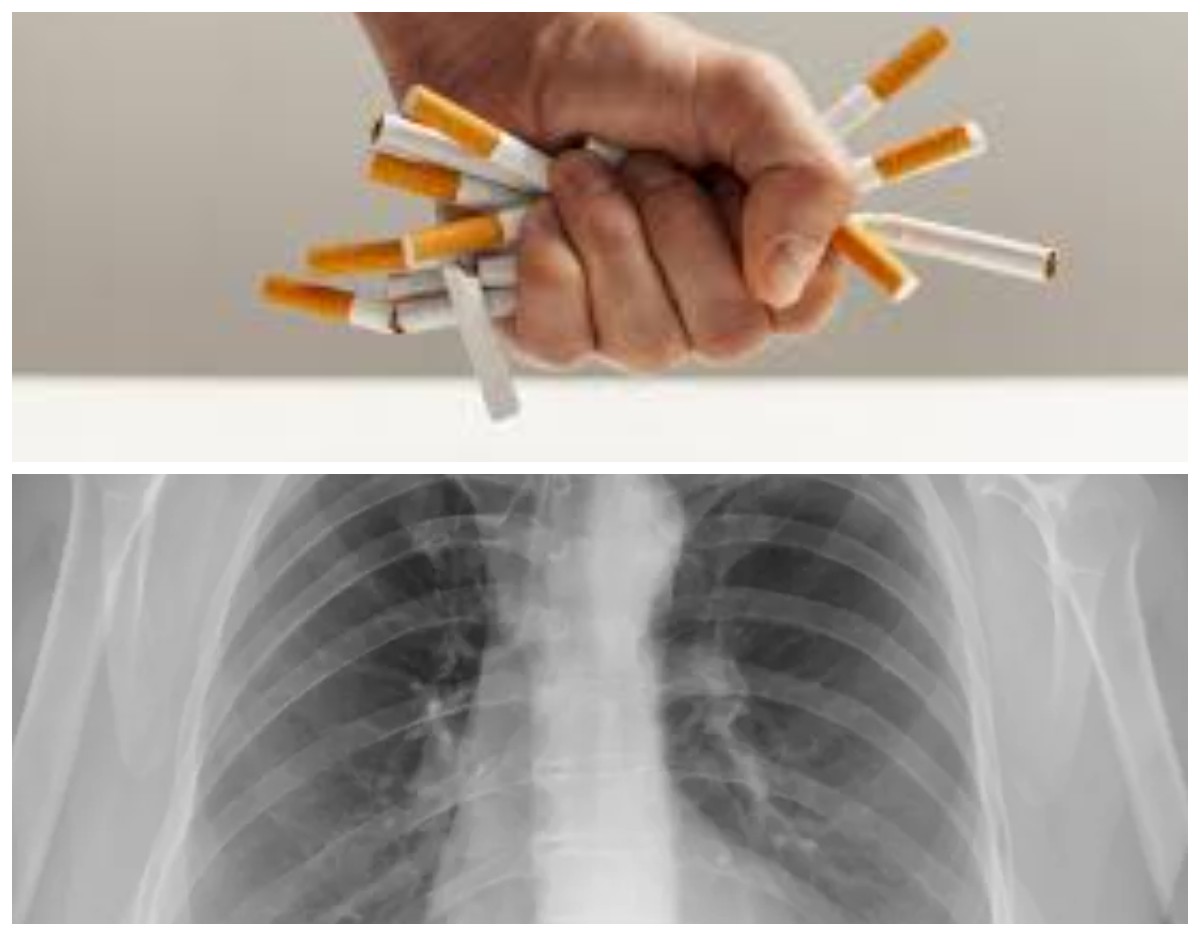 Cara Ampuh Membersihkan Paru-paru untuk Perokok Aktif