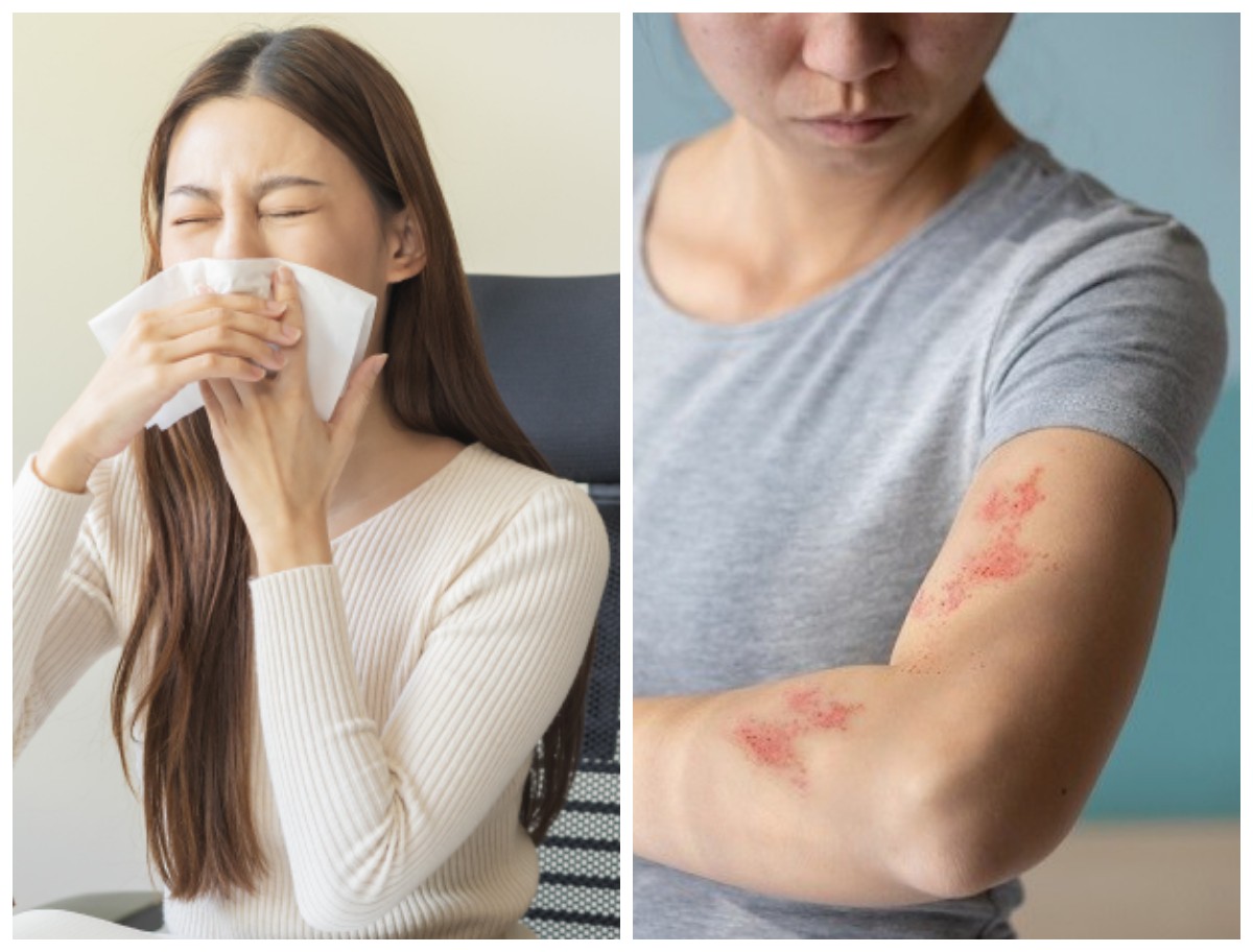 Solusi Mengatasi Alergi Debu dan Dingin: Tetap Nyaman di Segala Cuaca!