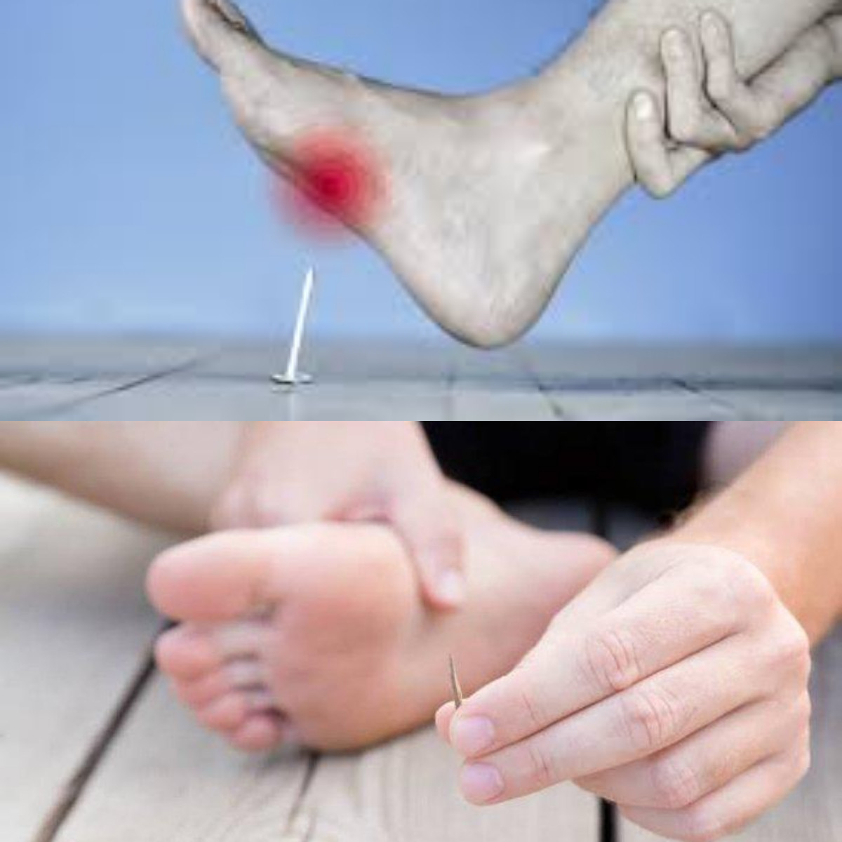 6 Obat Tetanus agar Infeksi Tidak Makin Parah!