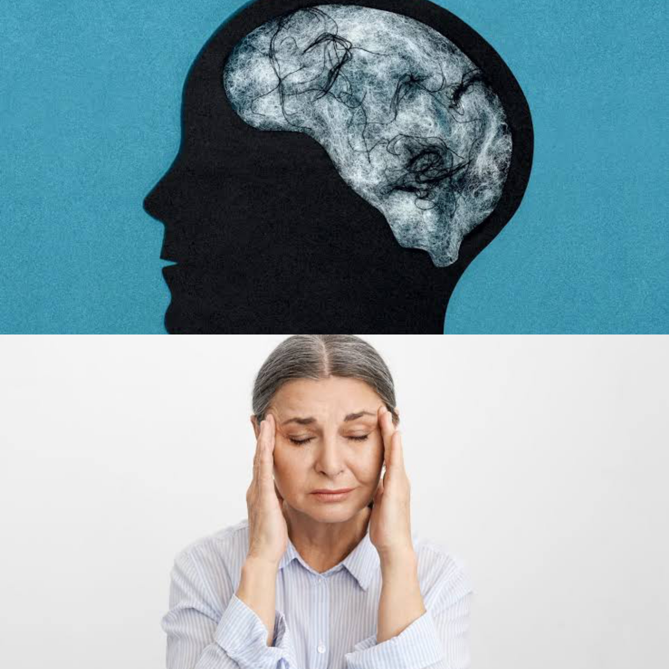Brain Fog: Kondisi Otak Terasa 