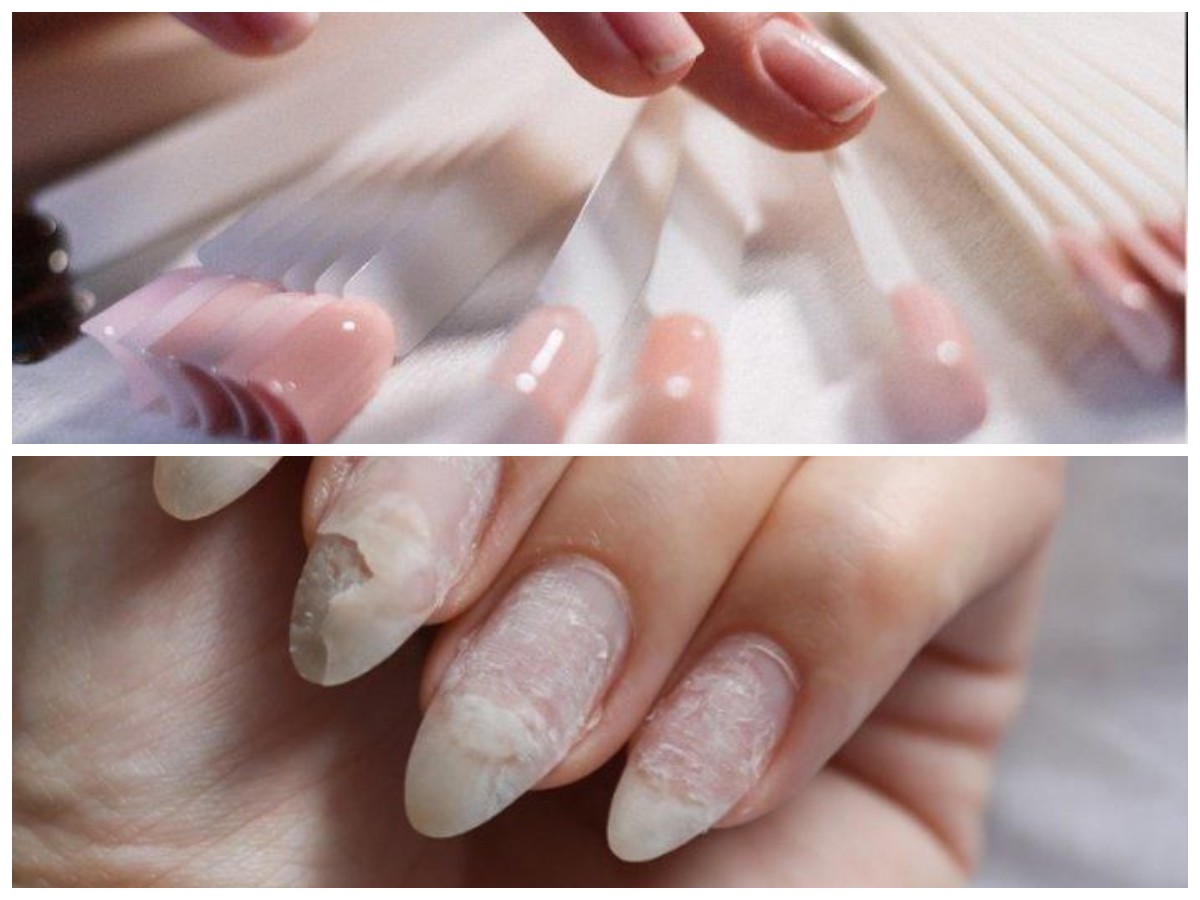 Sekilas Cantik, Tersimpan Bahaya: Efek Samping Kuku Palsu yang Wajib Diketahui